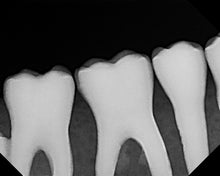 Load image into Gallery viewer, Dexis 601P Dental Digital Intraoral X-Ray Sensor Size 2