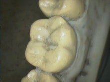 Load image into Gallery viewer, Air Techniques CamX Elara Dental High-Resolution Intraoral Camera