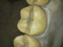 Load image into Gallery viewer, Air Techniques CamX Elara Dental High-Resolution Intraoral Camera