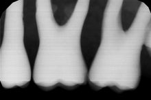 Load image into Gallery viewer, Gendex GXS-700 Dental Digital Intraoral X-Ray Sensor Size 1