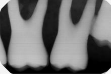 Load image into Gallery viewer, Gendex GXS-700 Dental Intraoral X-Ray Sensor Size 1