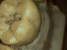 Load image into Gallery viewer, DigitalDOC Iris Dental Intraoral Camera Imaging Unit