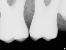 Load image into Gallery viewer, NEW UNUSED Sirona Schick 33/Elite Interface