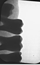 Load image into Gallery viewer, Air Techniques ScanX Duo Touch Dental PSP Phosphor Plate X-Ray Scanner
