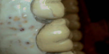 Load image into Gallery viewer, Digital DOC Iris Dental Intraoral Camera System