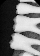 Load image into Gallery viewer, Vatech EzSensor HD Size 2 Digital Dental X-Ray Sensor USB RVG Imaging System