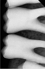 Load image into Gallery viewer, Vatech EzSensor HD Size 1.0 Digital Dental X-Ray Sensor USB RVG Imaging