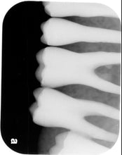 Load image into Gallery viewer, Air Techniques ScanX Swift Digital Dental Intraoral X-Ray Phosphor Plate Scanner