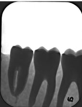 Load image into Gallery viewer, Air Techniques ScanX Duo PSP Digital Dental Radiography Scanner