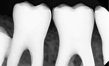 Load image into Gallery viewer, Digital Doc Blu Dental Digital Intraoral X-Ray Sensor Size 1
