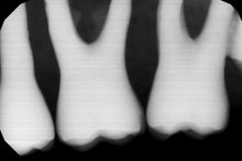 Load image into Gallery viewer, Gendex GXS-700 Dental Digital Intraoral X-Ray Sensor Size 1
