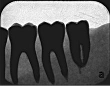 Load image into Gallery viewer, Air Techniques ScanX Classic Dental X-Ray Phosphor Plate Scanner
