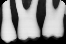 Load image into Gallery viewer, Gendex GXS-700 Dental Intraoral X-Ray Sensor Size 1
