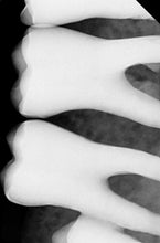 Load image into Gallery viewer, Vatech EzSensor HD 1.0 Dental Intraoral X-Ray Sensor 32 &amp; 64 bit USB
