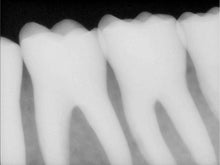 Load image into Gallery viewer, Carestream Kodak RVG 6100 Size 1 Dental Sensor

