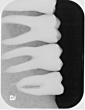 Load image into Gallery viewer, Air Techniques ScanX 2 IO Dental Phosphor Plate Scanner F3605 Digital Imaging
