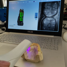 Load image into Gallery viewer, Planmeca PlanScan Dental Intraoral Scanner for CAD/CAM Dentistry
