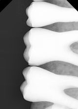 Load image into Gallery viewer, Vatech EZ Sensor HD Digital X-Ray Sensor Size 1.5 - Without Dock &amp; Software/Drivers
