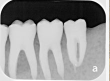 Load image into Gallery viewer, Air Techniques ScanX 2 IO Dental Phosphor Plate X-Ray Scanner
