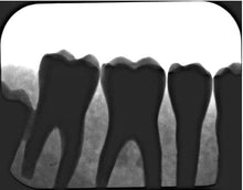 Load image into Gallery viewer, Air Techniques ScanX 2 IO Dental Phosphor Plate X-Ray Scanner
