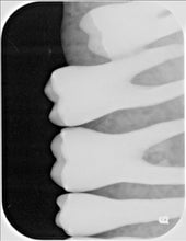 Load image into Gallery viewer, Air Techniques ScanX IO Dental Digital Phosphor X-Ray Scanner
