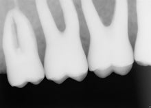 Load image into Gallery viewer, Sirona XIOS XG Supreme Digital Intraoral Dental X-Ray Sensor Schick Size 2
