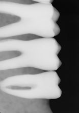 Load image into Gallery viewer, Sirona Schick 33 Size 2 Digital Dental Intraoral X-Ray Sensor
