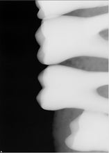 Load image into Gallery viewer, Sirona Schick 33 Size 2 Digital Dental Intraoral X-Ray Sensor
