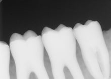 Load image into Gallery viewer, Dentsply Sirona Schick 33 Size 2 Digital Dental X-Ray Sensor
