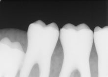 Load image into Gallery viewer, Dentsply Sirona Schick 33 Size 2 Digital Dental X-Ray Sensor
