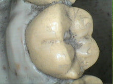 Load image into Gallery viewer, Acteon SOPRO 717 First Dental Intraoral Camera Imaging Unit- No Software
